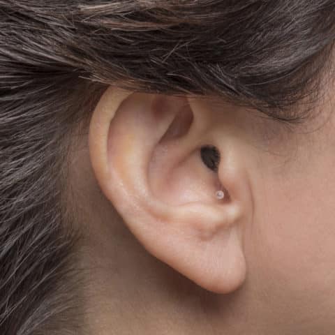 IIC: Invisible in-the-canal Hearing AId